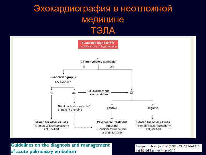 Эхокардиография в неотложной медицине ТЭЛА 