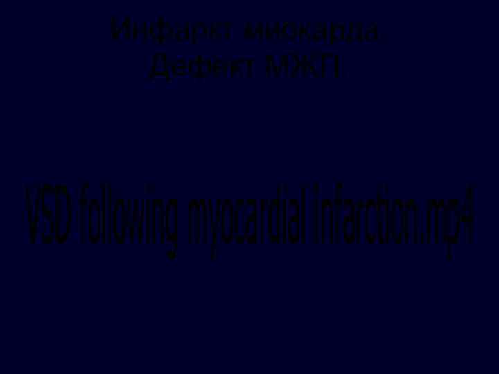 Инфаркт миокарда. Дефект МЖП. 
