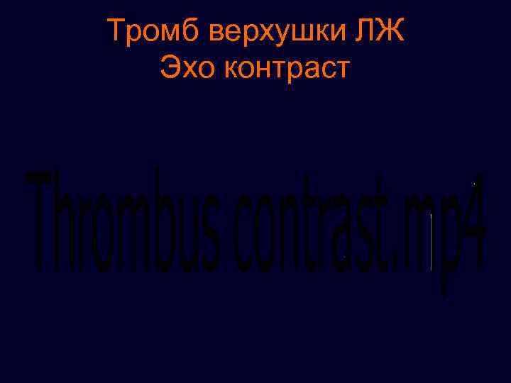 Тромб верхушки ЛЖ Эхо контраст 