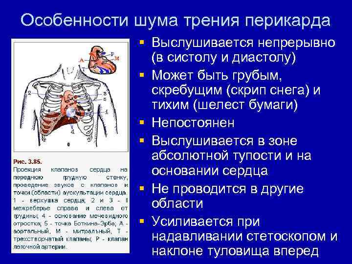 Шум остина флинта выслушивается в точке обозначенной на рисунке цифрой