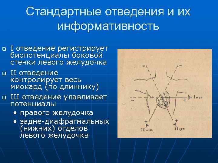 Стандартные отведения и их информативность q q q I отведение регистрирует биопотенциалы боковой стенки