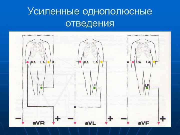Усиленные однополюсные отведения 