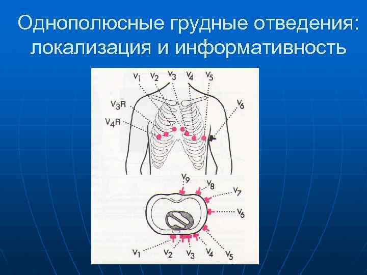 Однополюсные грудные отведения: локализация и информативность 