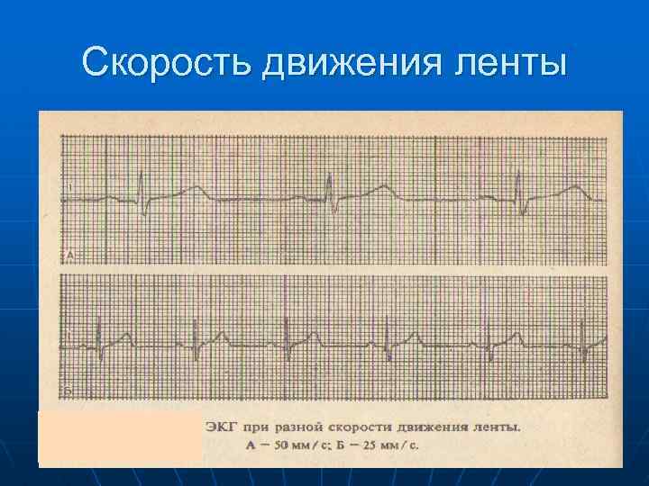 Скорость движения ленты 