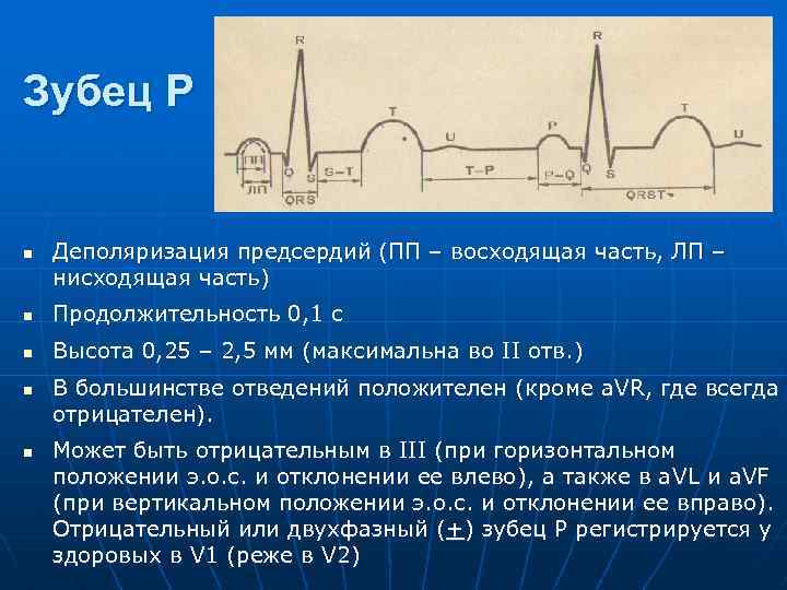 Зубец Р n Деполяризация предсердий (ПП – восходящая часть, ЛП – нисходящая часть) n