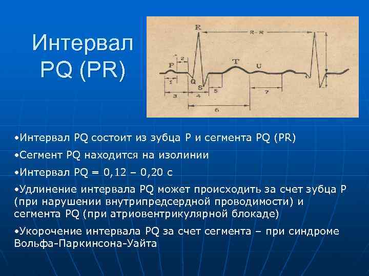 Интервал PQ (PR) • Интервал PQ состоит из зубца P и сегмента PQ (PR)