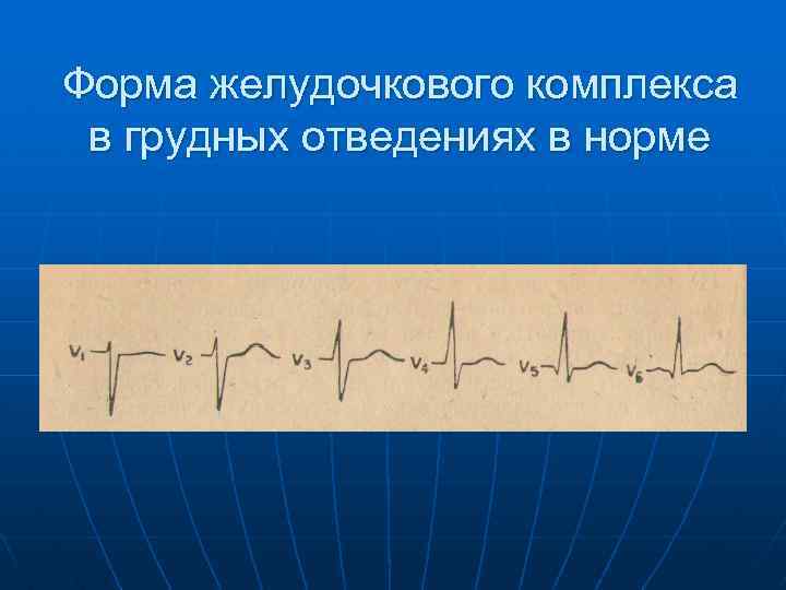 Форма желудочкового комплекса в грудных отведениях в норме 