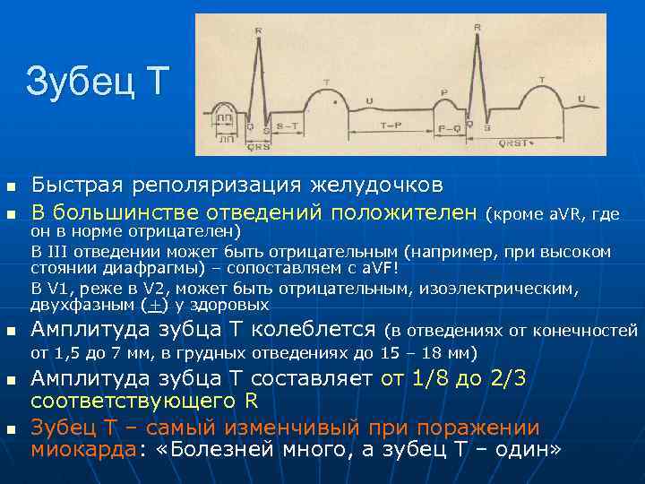 Зубец Т n Быстрая реполяризация желудочков В большинстве отведений положителен n Амплитуда зубца Т