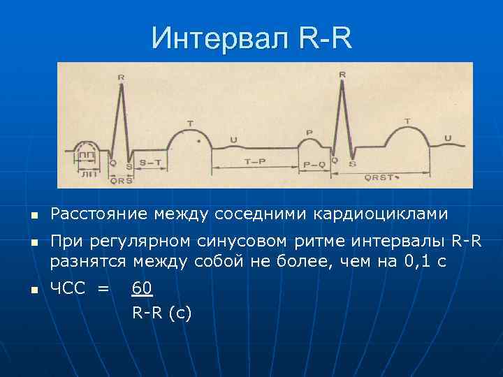 Интервал R-R n n n Расстояние между соседними кардиоциклами При регулярном синусовом ритме интервалы