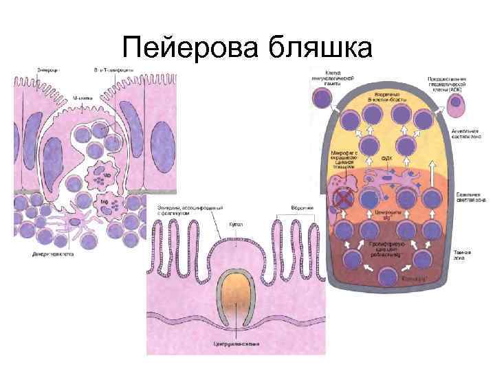 Пейеровы бляшки