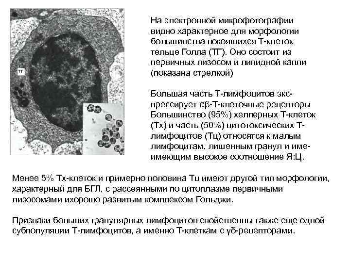 На электронной микрофотографии видно характерное для морфологии большинства покоящихся Т-клеток тельце Голла (ТГ). Оно