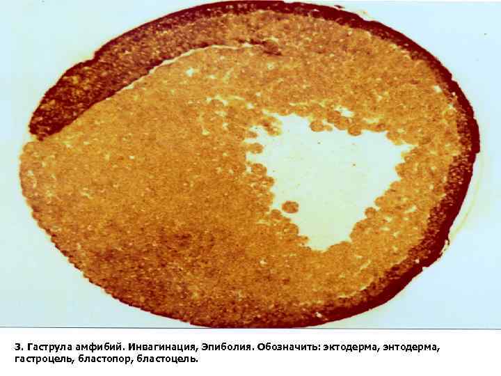 3. Гаструла амфибий. Инвагинация, Эпиболия. Обозначить: эктодерма, энтодерма, гастроцель, бластопор, бластоцель. 