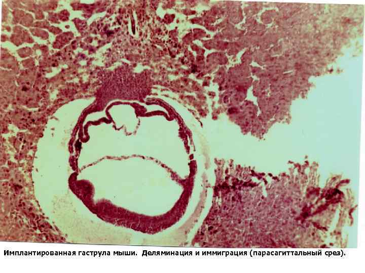 Имплантированная гаструла мыши. Деляминация и иммиграция (парасагиттальный срез). 