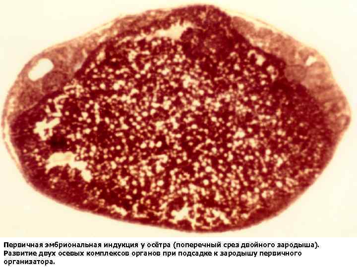 Первичная эмбриональная индукция у осётра (поперечный срез двойного зародыша). Развитие двух осевых комплексов органов