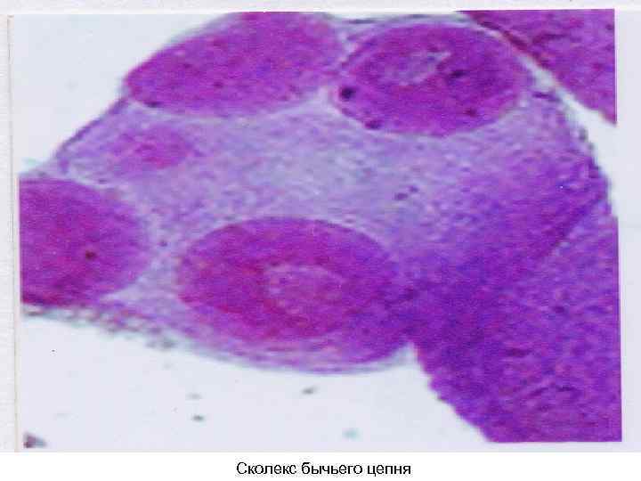 Сколекс бычьего цепня 