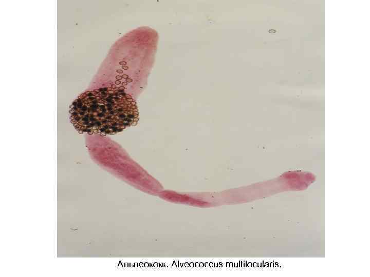 Альвеококк. Alveococcus multilocularis. 