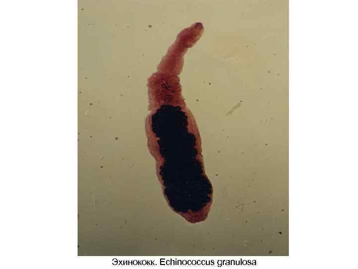 Эхинококк. Echinococcus granulosa 