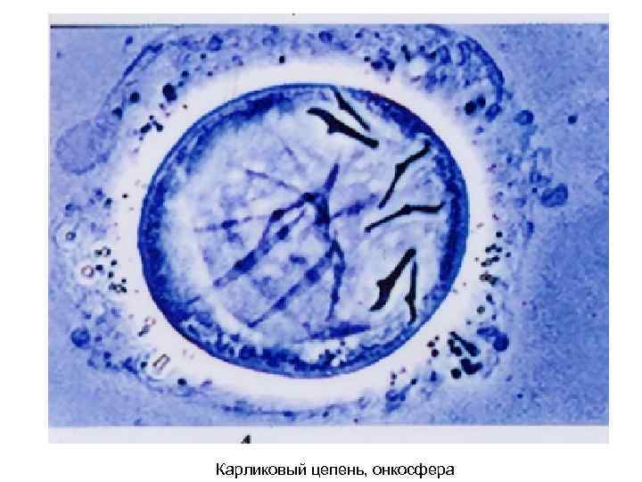 Карликовый цепень, онкосфера 
