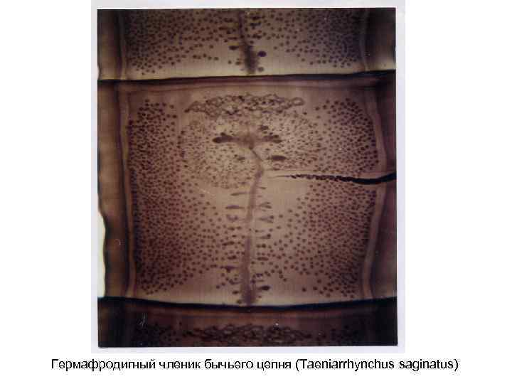 Гермафродигный членик бычьего цепня (Taeniarrhynchus saginatus) 