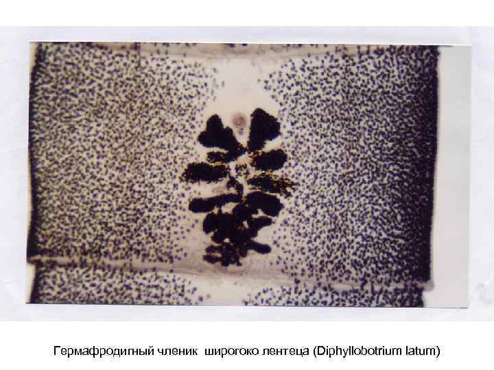 Гермафродигный членик широгоко лентеца (Diphyllobotrium latum) 