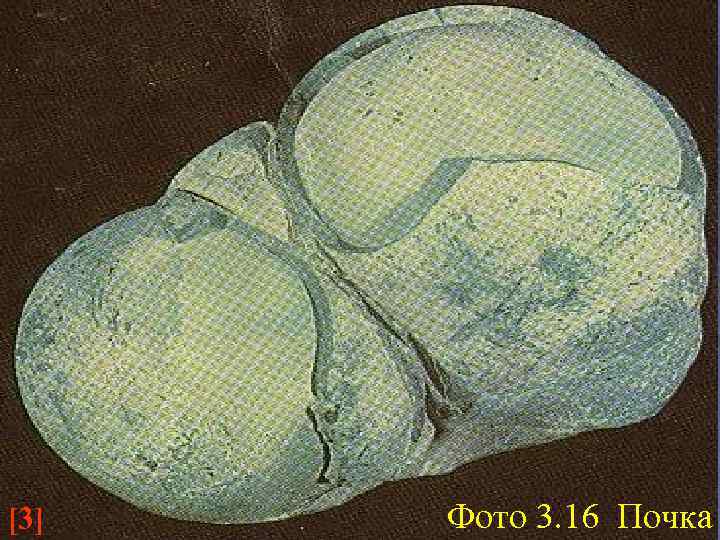 [3] Фото 3. 16 Почка 
