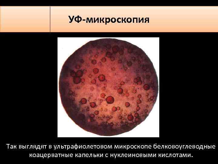 УФ-микроскопия Так выглядят в ультрафиолетовом микроскопе белковоуглеводные коацерватные капельки с нуклеиновыми кислотами. 