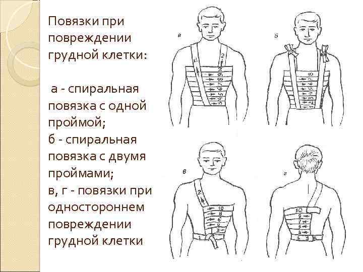 Поверхностная травма грудной клетки карта вызова