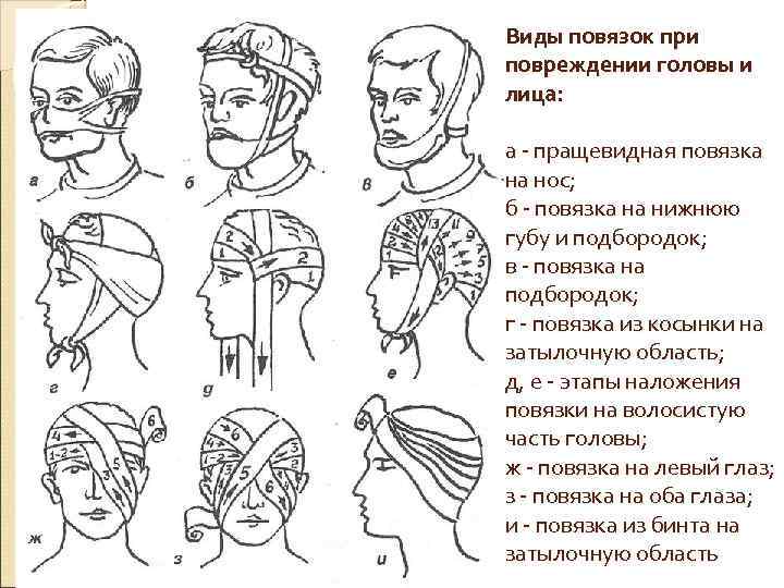 Виды повязок при повреждении головы и лица: а - пращевидная повязка на нос; б