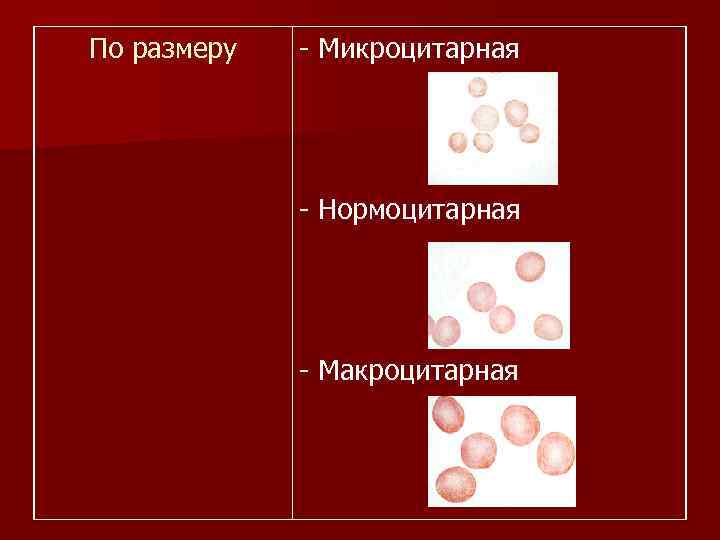 По размеру - Микроцитарная - Нормоцитарная - Макроцитарная 