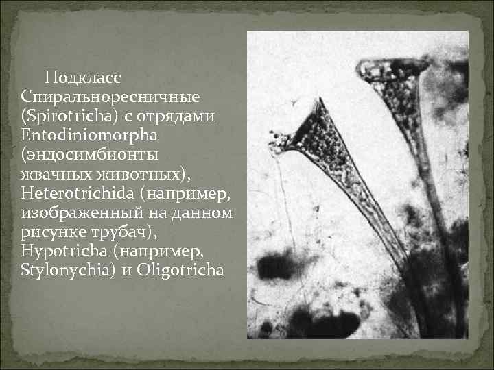 Подкласс Спиральноресничные (Spirotricha) с отрядами Entodiniomorpha (эндосимбионты жвачных животных), Heterotrichida (например, изображенный на данном