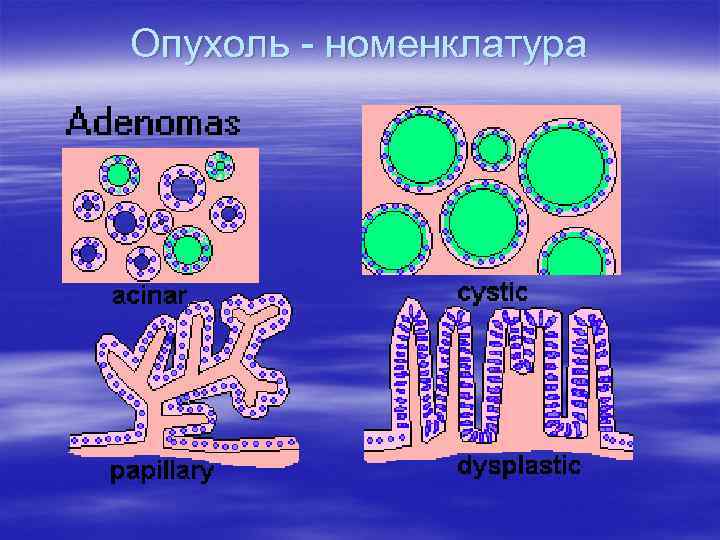 Опухоль - номенклатура 