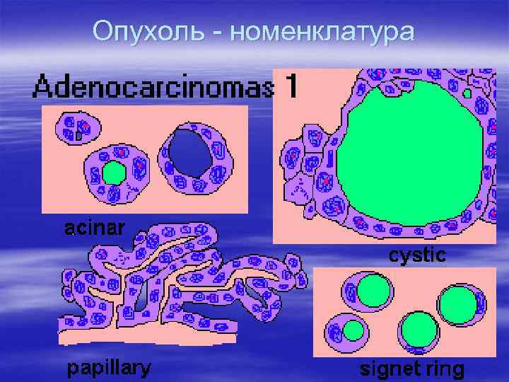 Опухоль - номенклатура 