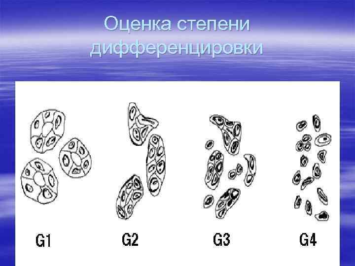 Оценка степени дифференцировки 