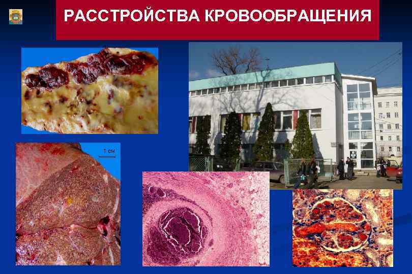 РАССТРОЙСТВА КРОВООБРАЩЕНИЯ 