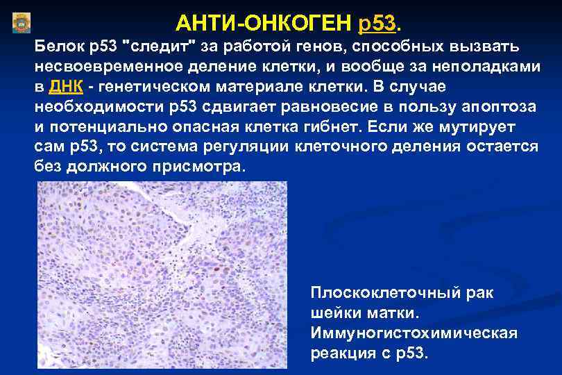 АНТИ-ОНКОГЕН р53. Белок р53 