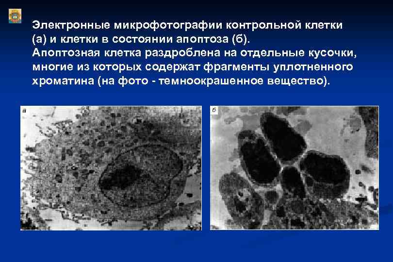 Электронные микрофотографии контрольной клетки (а) и клетки в состоянии апоптоза (б). Апоптозная клетка раздроблена