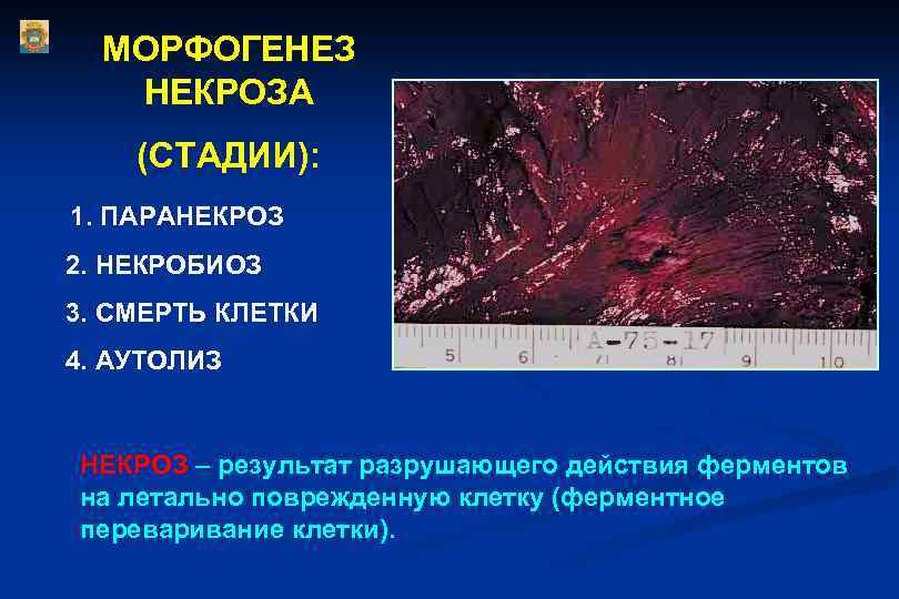 МОРФОГЕНЕЗ НЕКРОЗА (СТАДИИ): 1. ПАРАНЕКРОЗ 2. НЕКРОБИОЗ 3. СМЕРТЬ КЛЕТКИ 4. АУТОЛИЗ НЕКРОЗ –