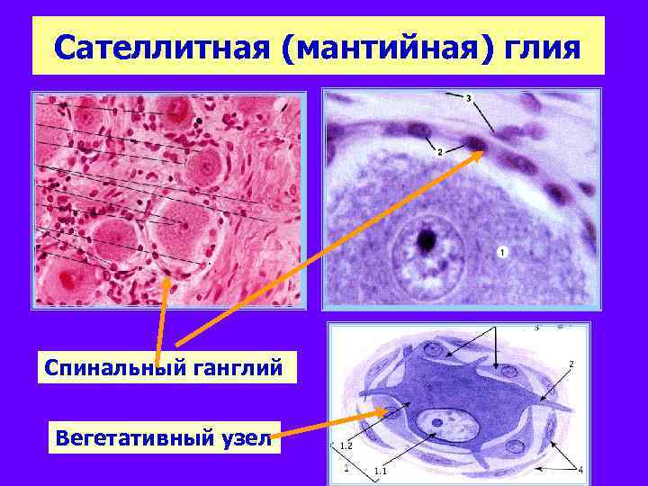 Сателлитная (мантийная) глия Спинальный ганглий Вегетативный узел 