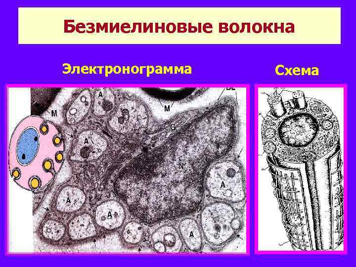 Безмиелиновые волокна Электронограмма Схема 