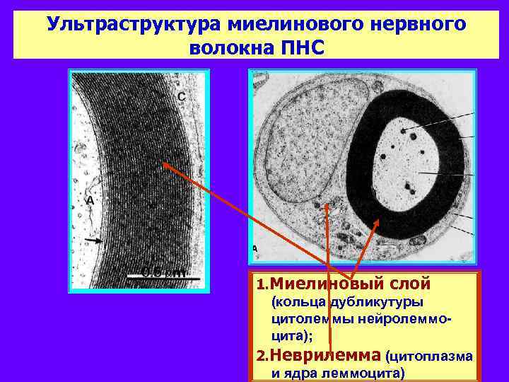 Ультраструктура миелинового нервного волокна ПНС 1. Миелиновый слой (кольца дубликутуры цитолеммы нейролеммоцита); 2. Неврилемма