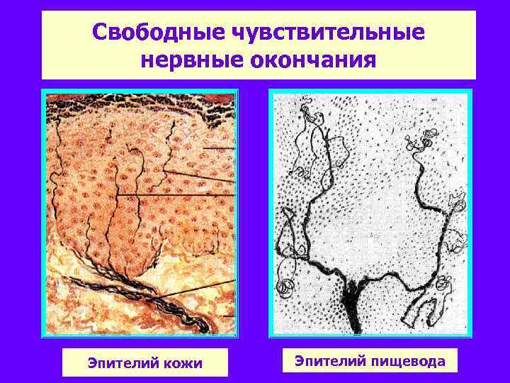 Свободные чувствительные нервные окончания Эпителий кожи Эпителий пищевода 