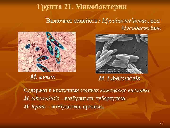 Группа 21. Микобактерии Включает семейство Mycobacteriaceae, род Mycobacterium. M. avium М. tuberculosis Содержат в
