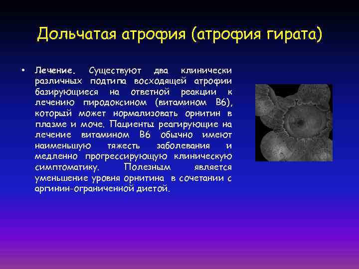 Дольчатая атрофия (атрофия гирата) • Лечение. Существуют два клинически различных подтипа восходящей атрофии базирующиеся