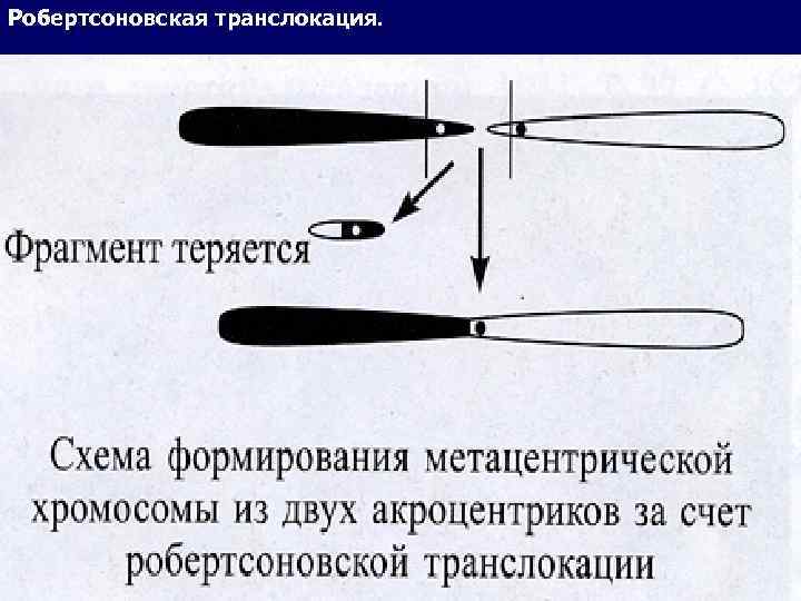 Робертсоновская транслокация. 