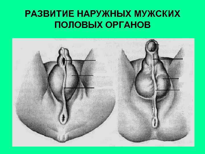РАЗВИТИЕ НАРУЖНЫХ МУЖСКИХ ПОЛОВЫХ ОРГАНОВ 