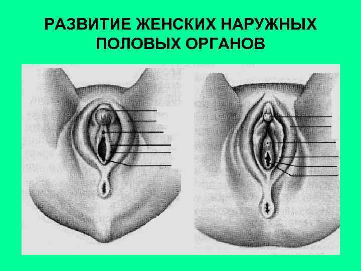 РАЗВИТИЕ ЖЕНСКИХ НАРУЖНЫХ ПОЛОВЫХ ОРГАНОВ 