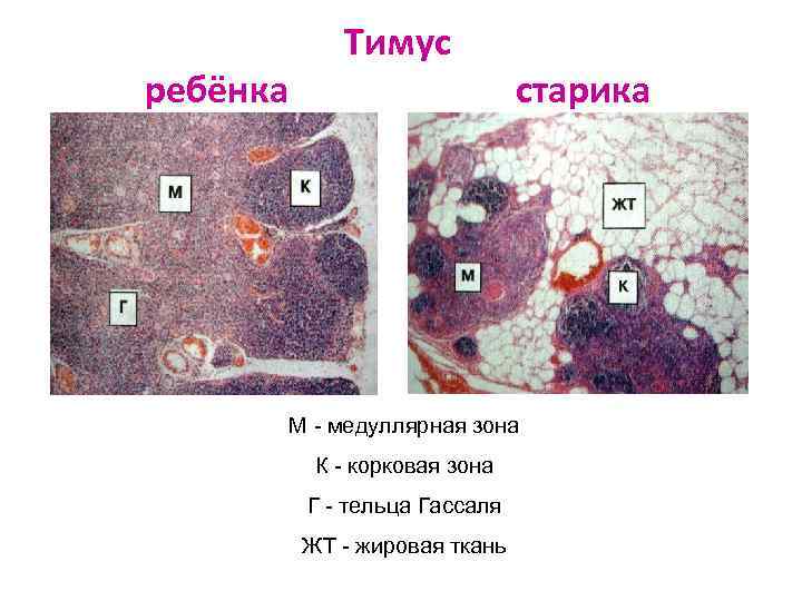 ребёнка Тимус старика М - медуллярная зона К - корковая зона Г - тельца