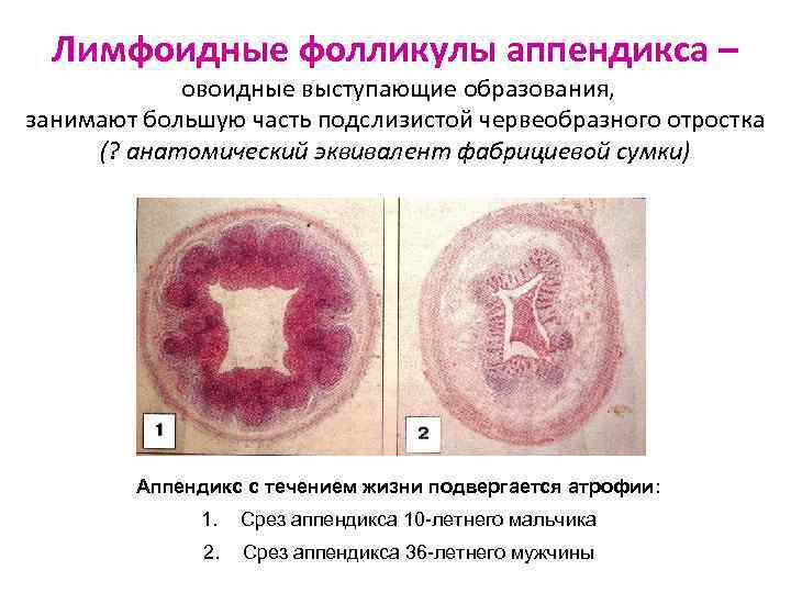 Лимфоидные фолликулы аппендикса – овоидные выступающие образования, занимают большую часть подслизистой червеобразного отростка (?