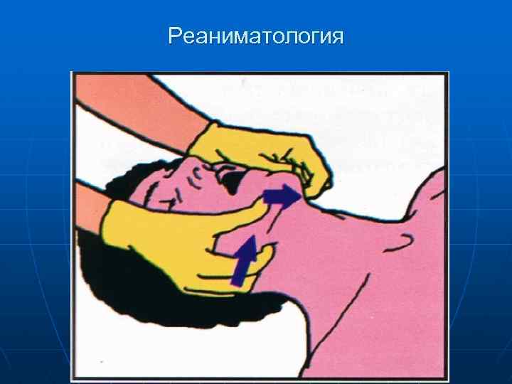 Реаниматология 