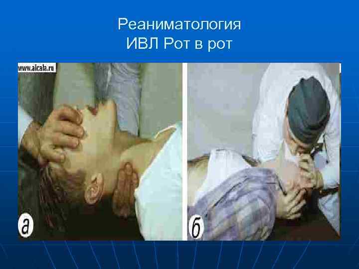 Реаниматология ИВЛ Рот в рот 